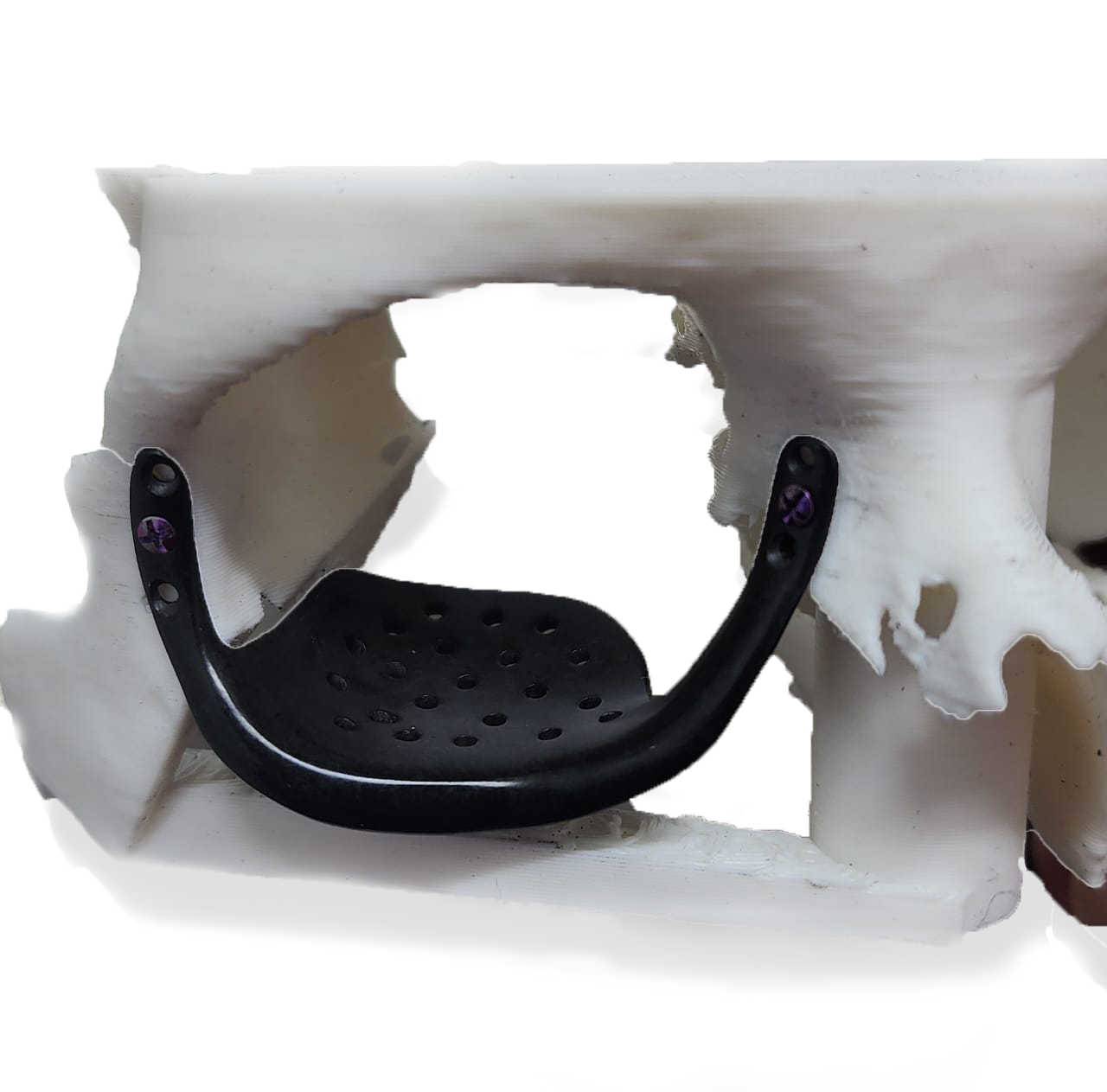 Caso maxilofacial 5