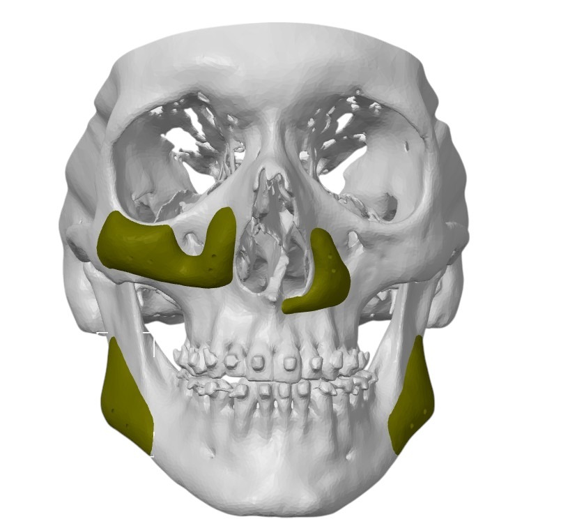 Maxilofacial Estético