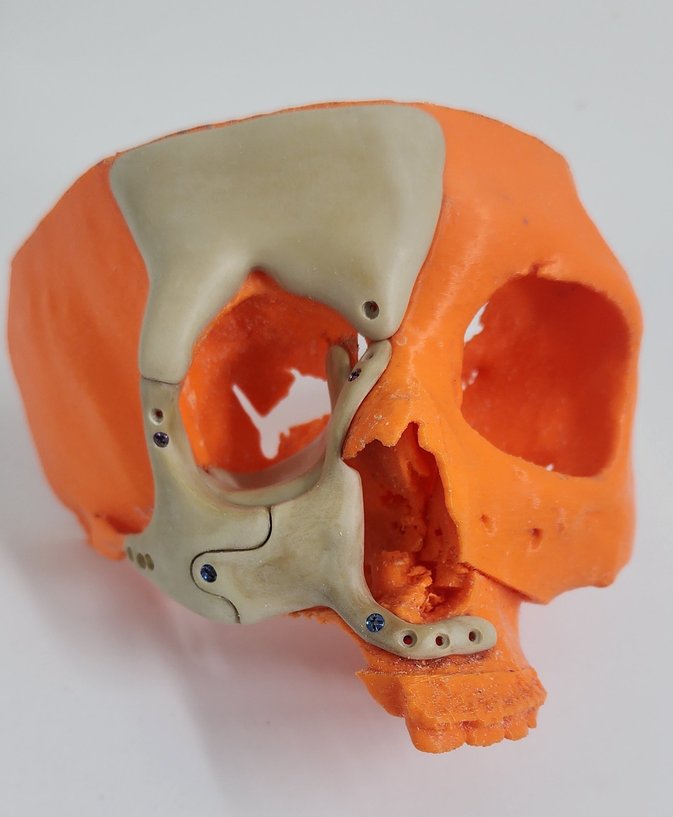 Caso maxilofacial 2