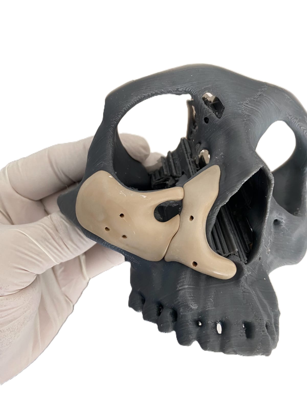 Caso maxilofacial 7