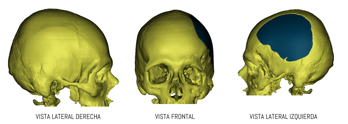 Imagen de visión